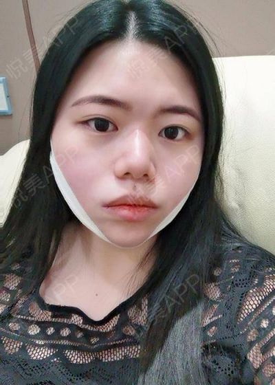 首先看到的是医院很干净，舒服。
前台小姐姐，很亲切，一到门口就热情的接待。
给我